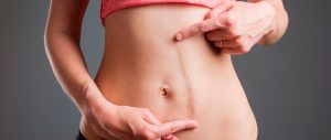 Descubre los tratamientos de recuperación de una una cirugía pélvica y/o abdominal de nuestro Servicio de fisioterapia de recuperación postquirúrgica en Alcalá de Henares