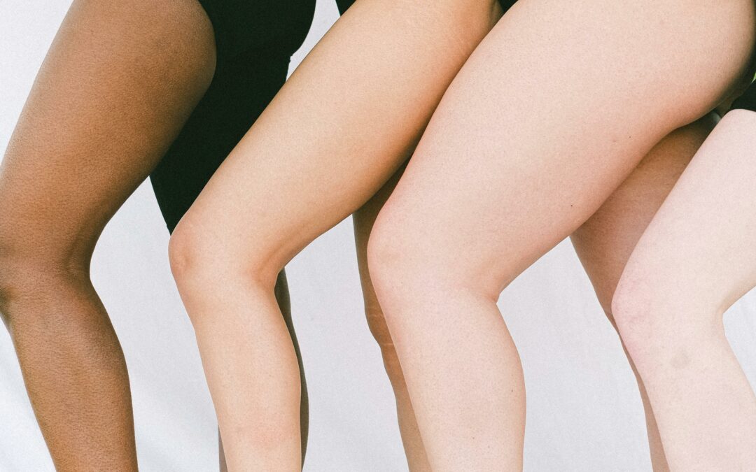5 Consejos para Quitar la Celulitis y Sentirte Radiante