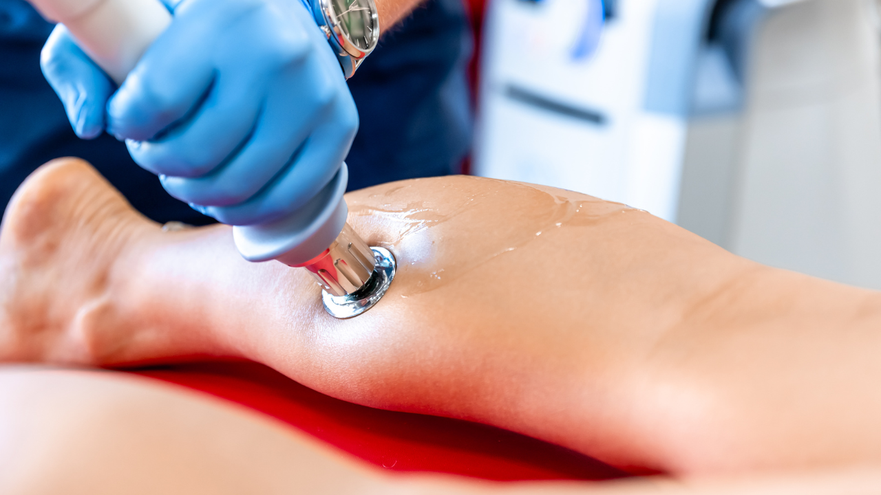 fascitis plantar con Ondas de choque Alcala de Henares fisioterapeuta haciendo un tratamiento de fisioterapia con ondas de choque en fascitis plantar