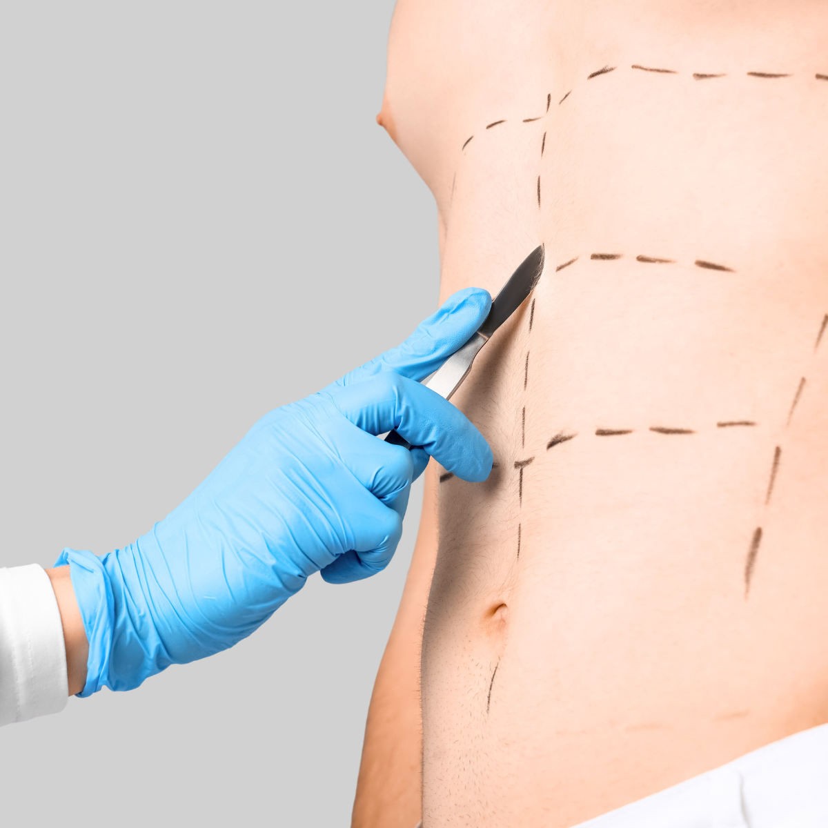 entrenamiento-de-abdomen-entrenamiento–alcala-de-henares-fisioandtherapies imagen de un abdomen pintado para simular el entrenamiento de abdomen en Alcala